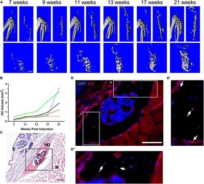 Gnas Inactivation Alters Subcutaneous Tissues in Progression to Heterotopic Ossification